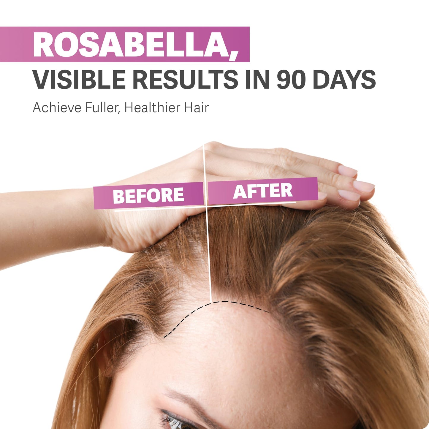 botella gomitas biotina para cabello rosabella