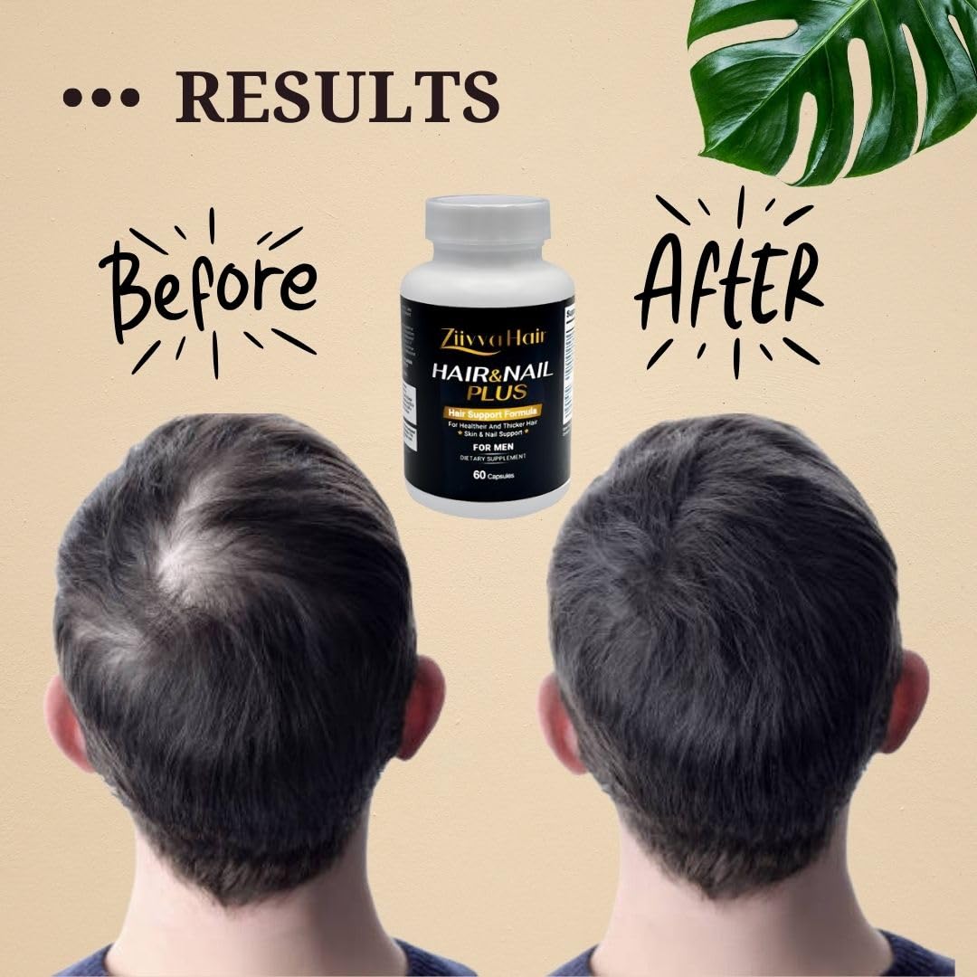 Cápsulas de biotina 5000 mcg para cabello Ziivva