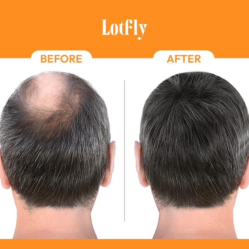 Cápsulas vegetales para crecimiento saludable de cabello y uñas
