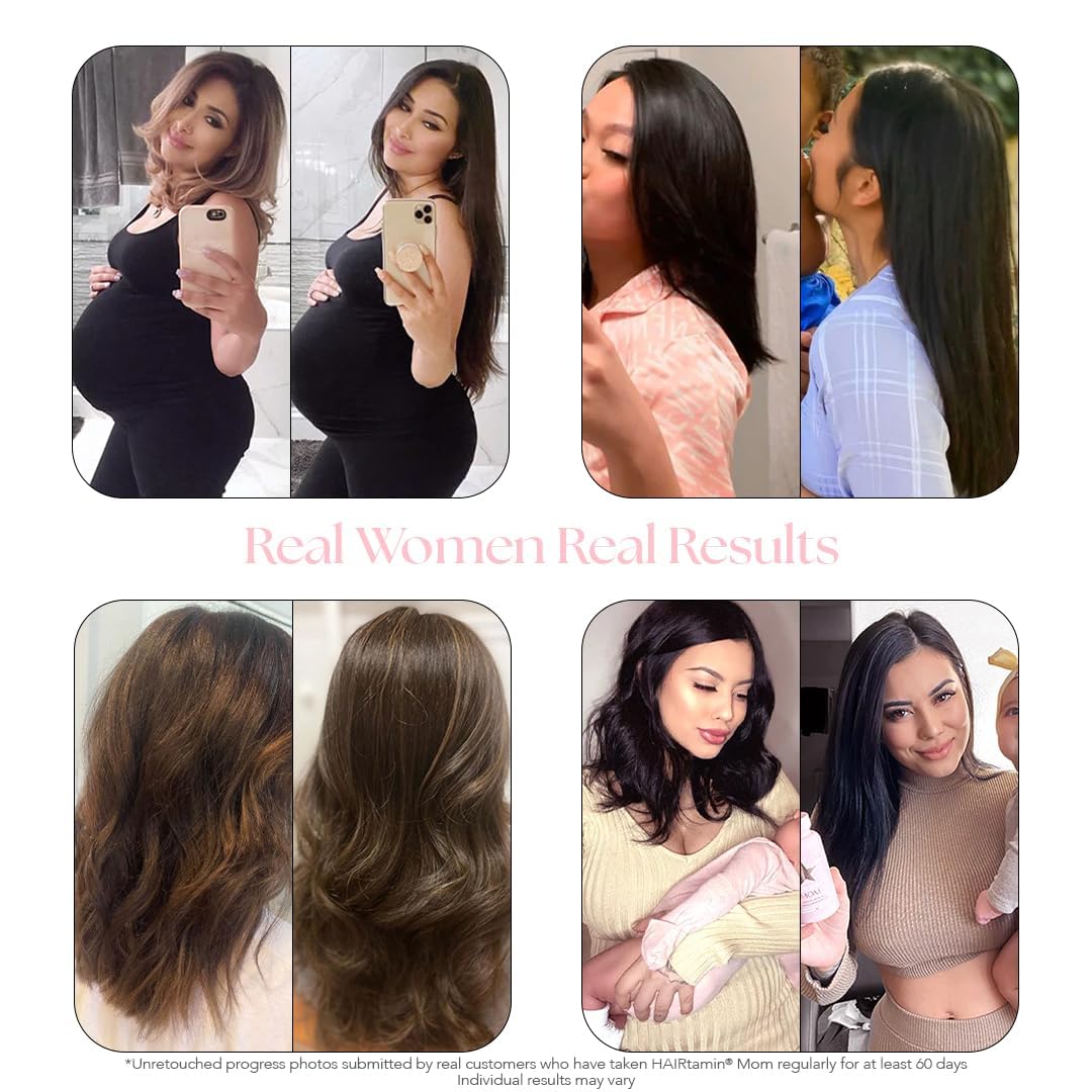 Etiqueta suplemento prenatal y postnatal HAIRtamin MOM