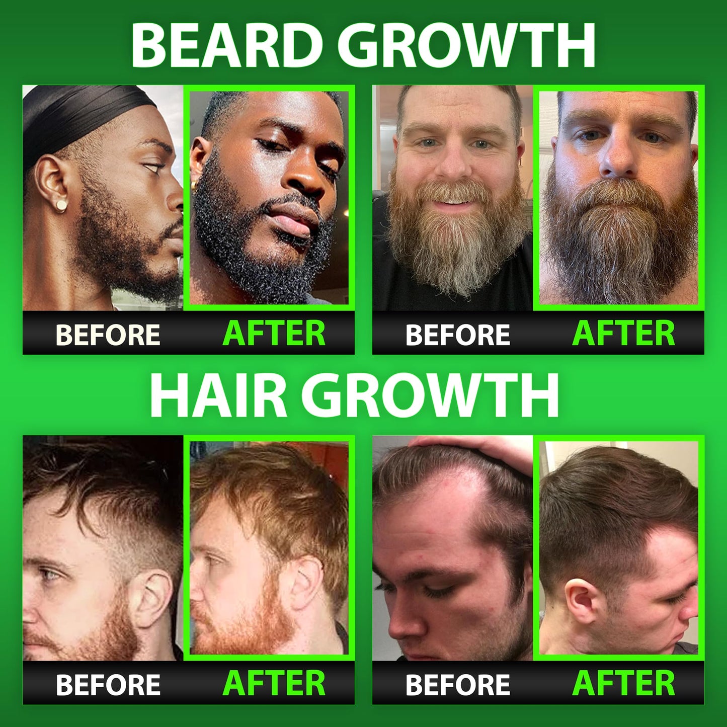 Gomitas vitaminas para barba y cabello máximo crecimiento