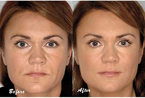 Suplemento para fortalecer uñas con biotina y vitaminas