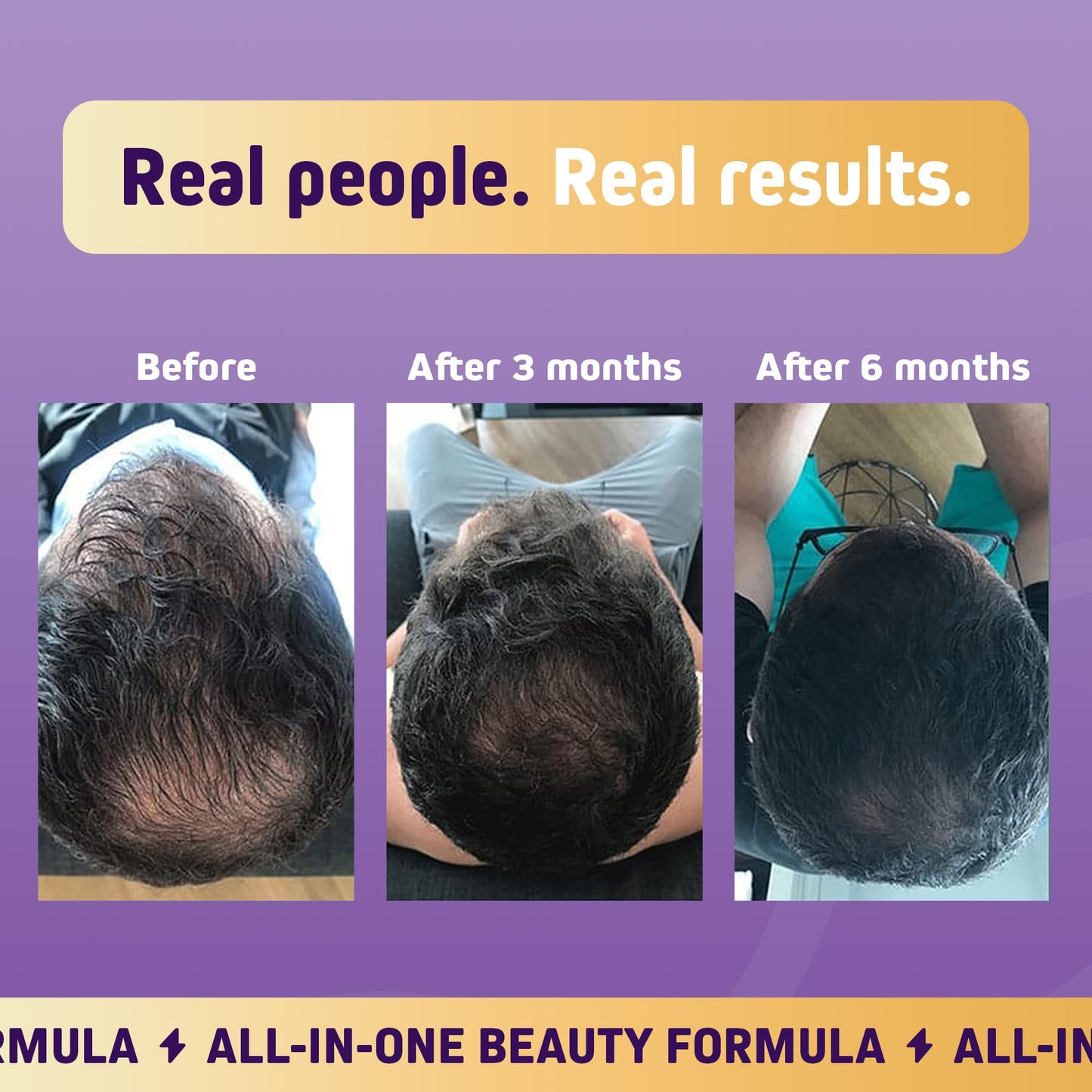 Suplemento Herbtonics para cabello piel uñas vitaminas