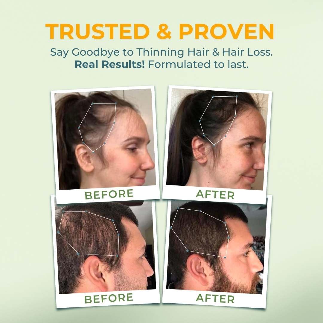 Vital Hair Complex envase para cabello saludable hombres y mujeres