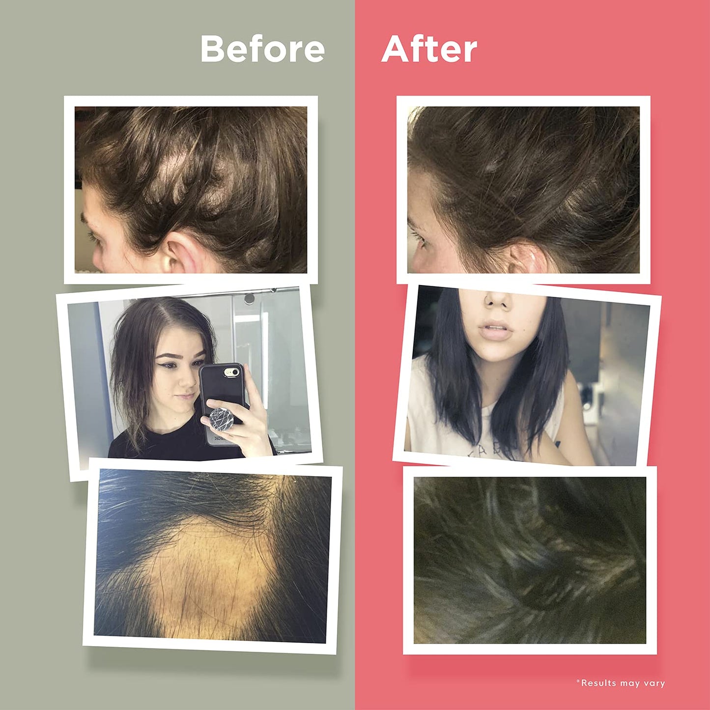 Vitaminas HairAnew para cabello y uñas saludables