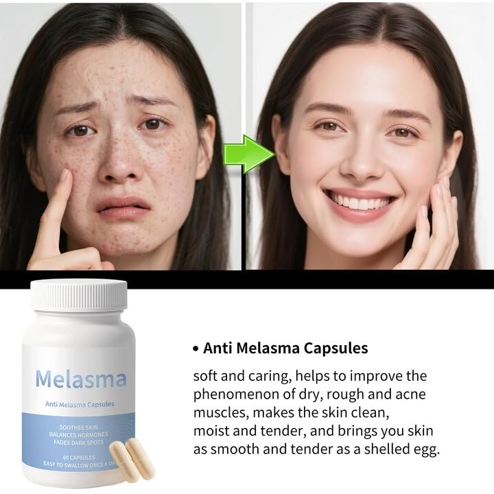 Cápsulas Yamlove para mejorar tono desigual y melasma