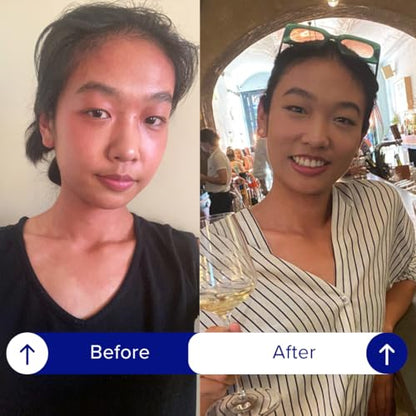 Antes y después del uso de parches IBLUSH