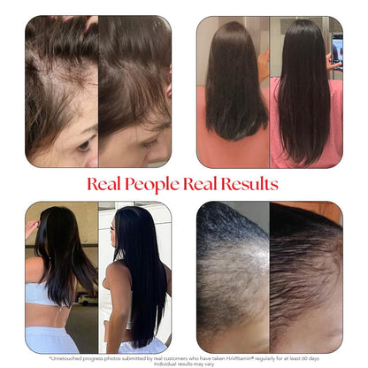 comparaciones de crecimiento de cabello con hairtamin