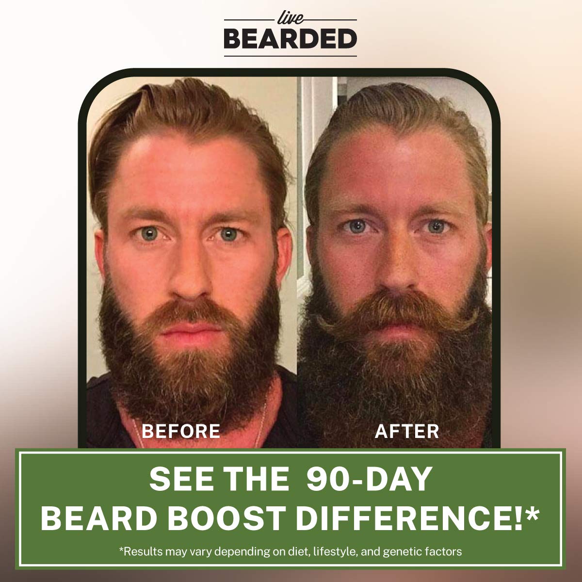 Frasco y caja Beard Boost multivitaminas para barba
