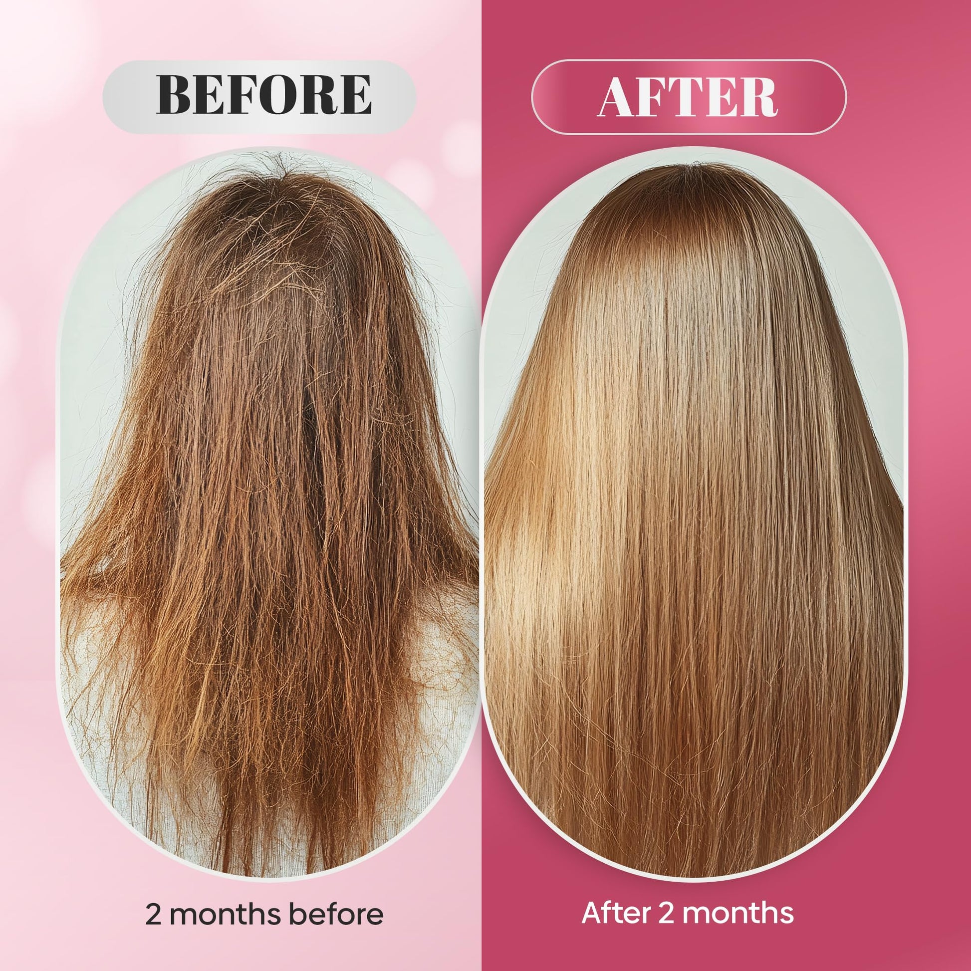 Nutrafemi gomitas biotina para cabello piel uñas paquete completo