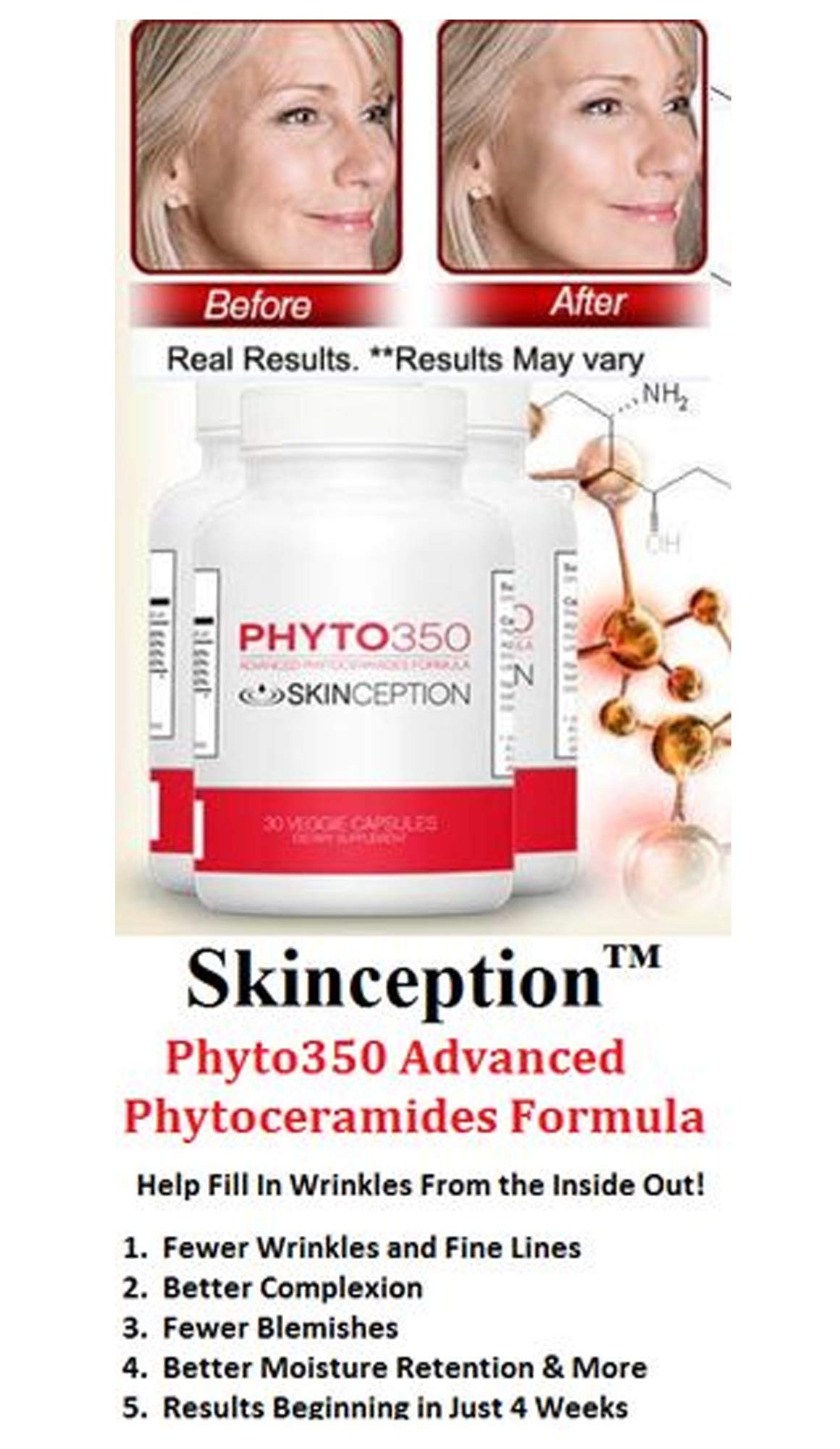 Resultados antes y después de usar Phyto350