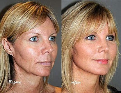 Tratamiento natural para piel y cabello Herbal Nutrition