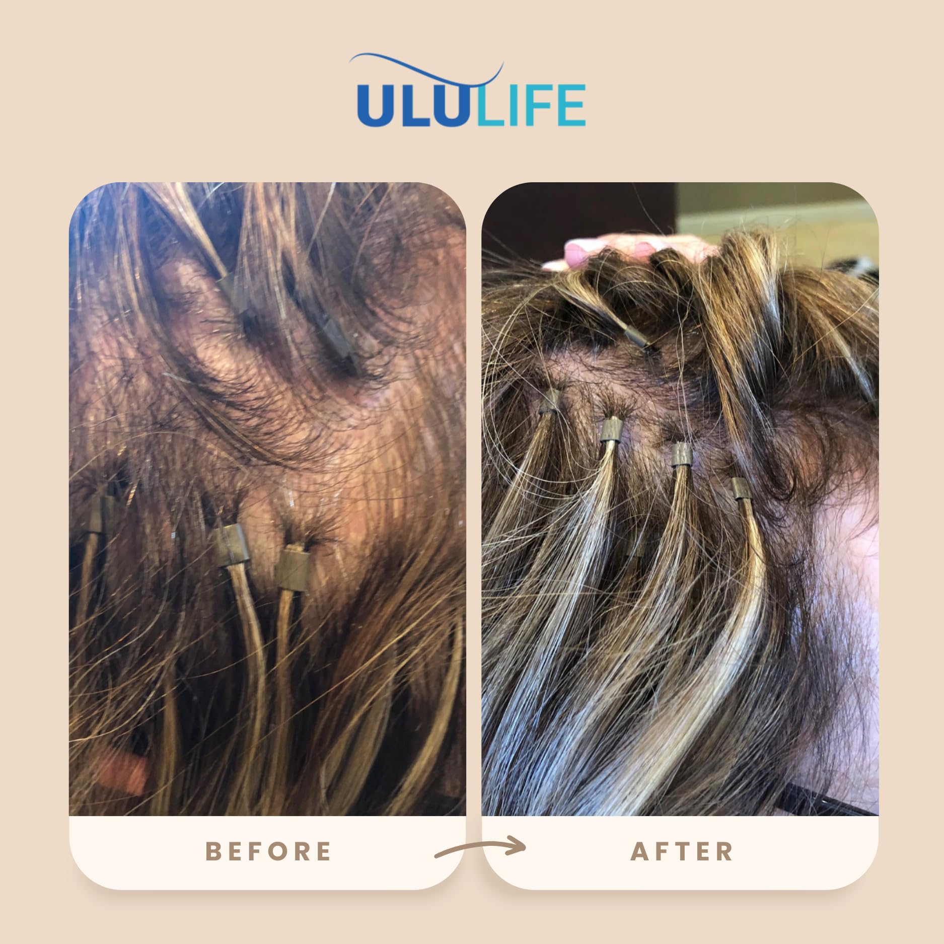 ULULIFE multivitamínico resultados visibles
