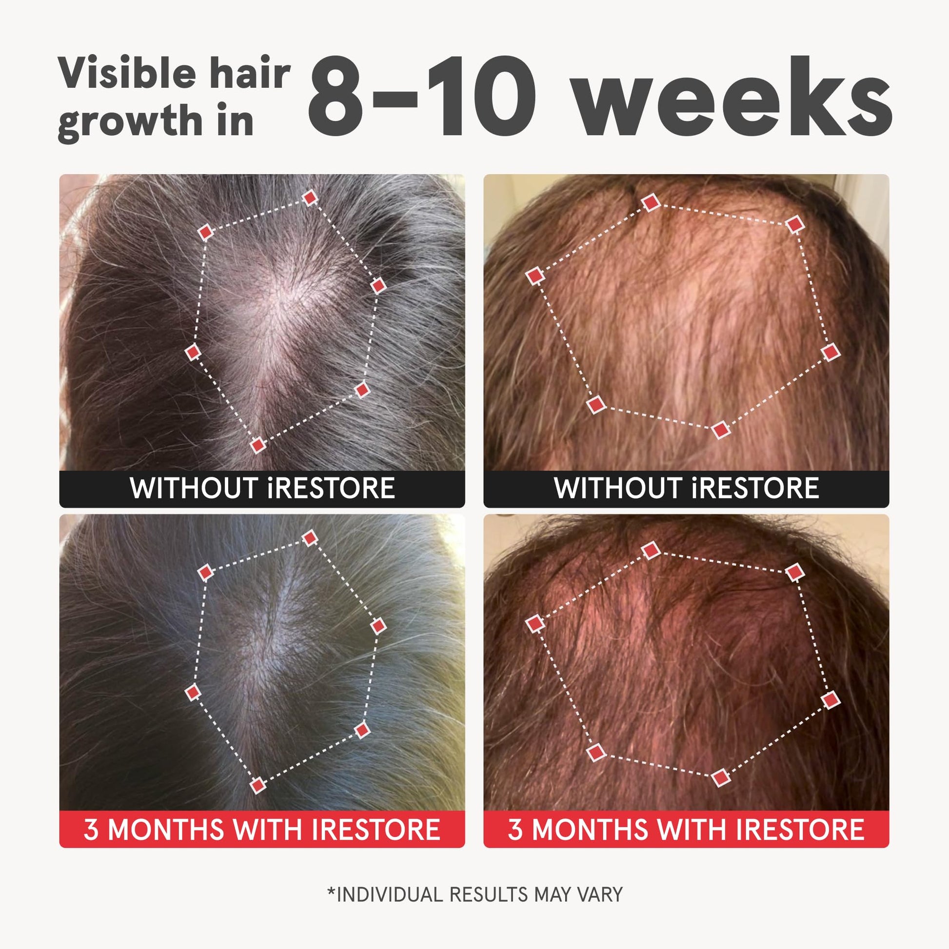 Vitaminas iRESTORE para cabello más grueso y voluminoso.