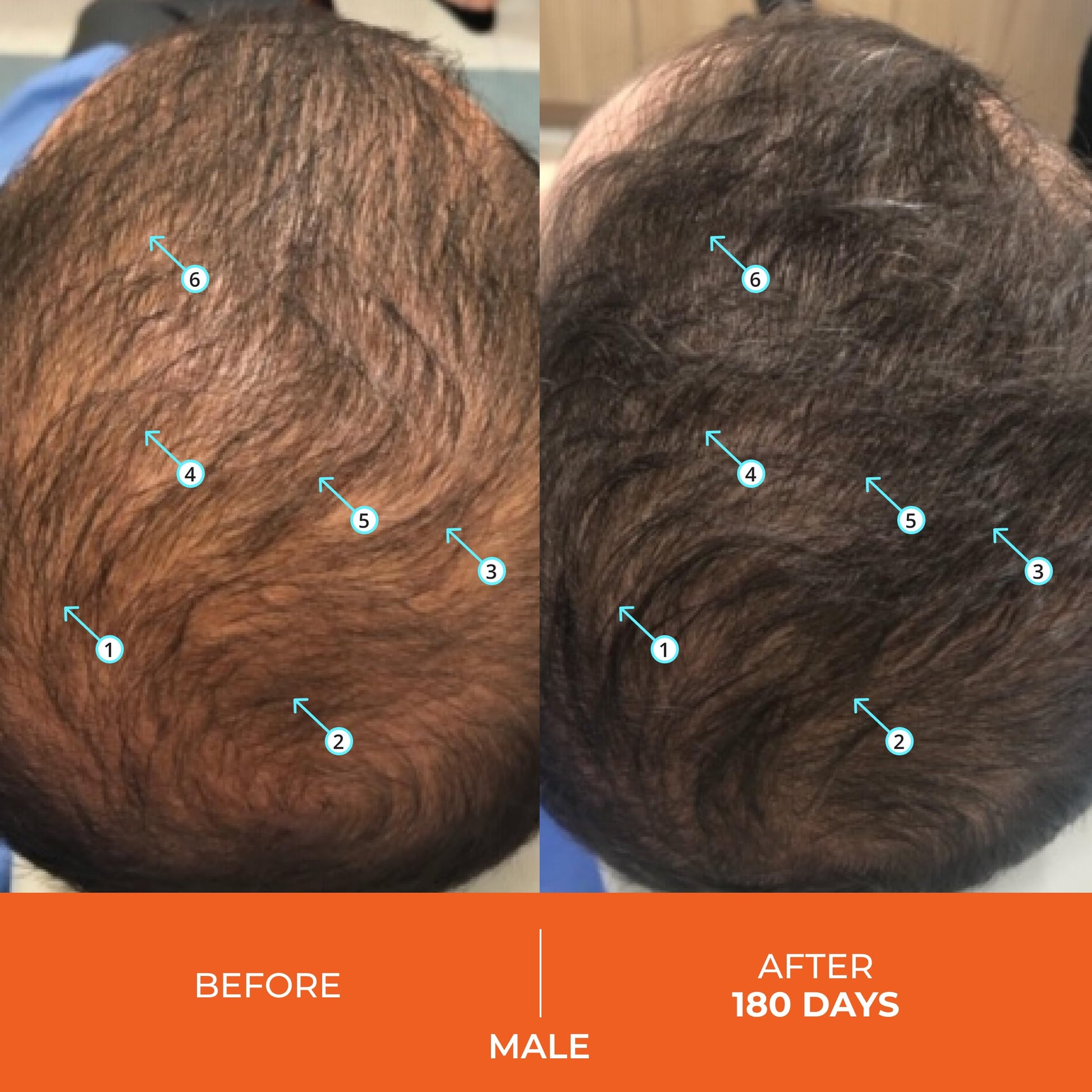 Vitaminas veganas para cabello y nutrición capilar