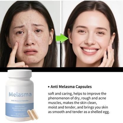 Cápsulas Yamlove para mejorar tono desigual y melasma