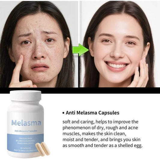 Cápsulas Yamlove para mejorar tono desigual y melasma