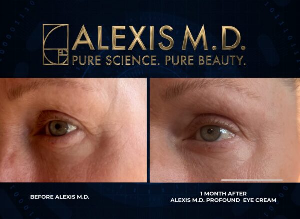 Etiqueta del producto Alexis M.D. Profound C Complex