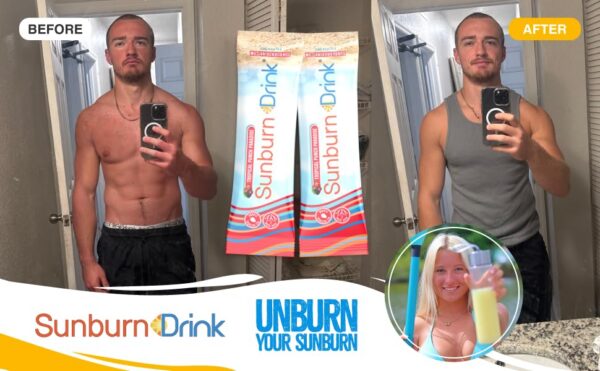 bebida sunburn aliviar quemaduras con sabor tropical refrescante