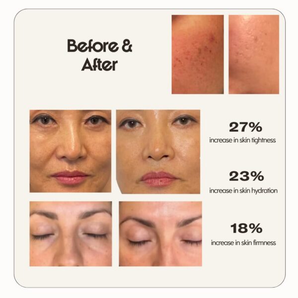 Bolsa de presentación de colágeno marino