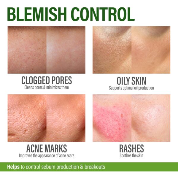 Cápsulas para acné y manchas Perfect Skin, envase naranja