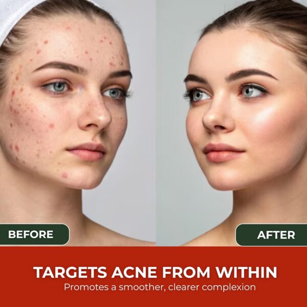 Cápsulas para piel clara y reducción de acné ZAFiNCO