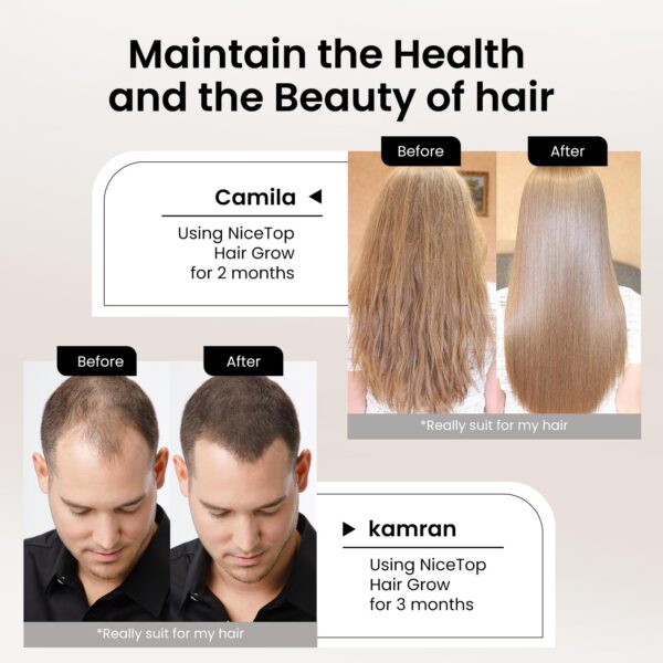 cápsulas vegetales NiceTop para el cabello