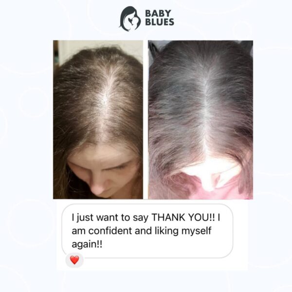 Cápsulas para pérdida de cabello posparto Baby Blues con colágeno y folato