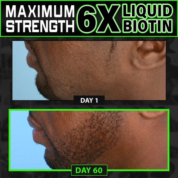 contenido gotas de biotina líquido para cabello y barba