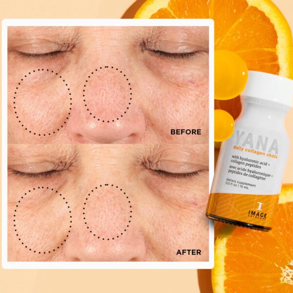 Version 1.0.0 Envase colágeno líquido sabor cítrico YANA