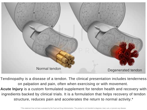 Etiqueta Pure TheraPro Rx fórmula clínica para soporte tendones y ligamentos