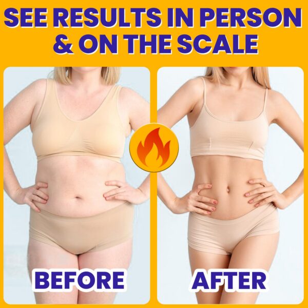 Etiqueta suplemento Lifeatlas GLP-1 probiótico Akkermansia