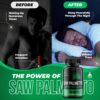 Version 1.0.0 Etiqueta del suplemento Saw Palmetto 500mg hombres