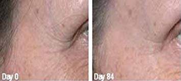 Ingredientes: GABA, acido hialuronico, CoQ10