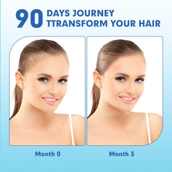 Gomitas para el crecimiento del cabello postparto