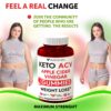 Gomitas Keto ACV para pérdida de peso digestiva