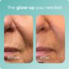Gotero de Biosil Collagen Booster