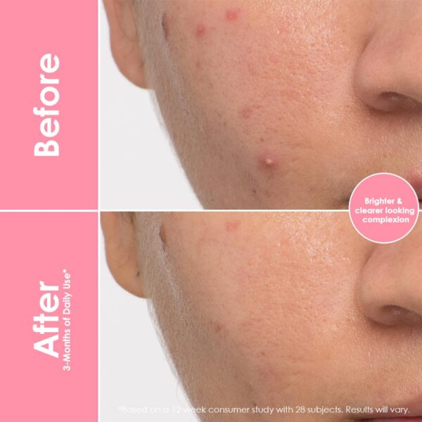 Frasco de gomitas con etiqueta