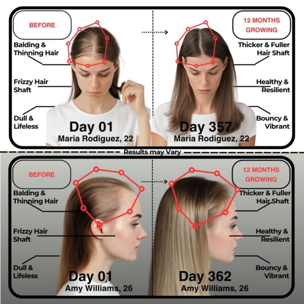 GummBear frasco gomitas