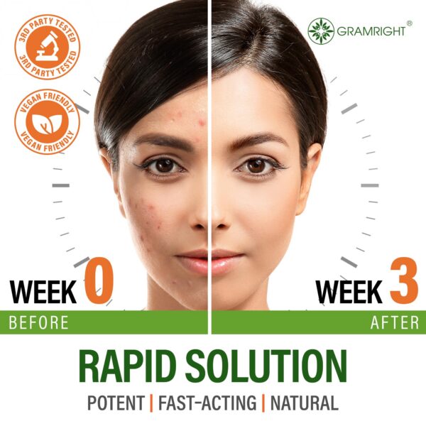 Ingredientes potentes para la piel en cápsulas Perfect Skin