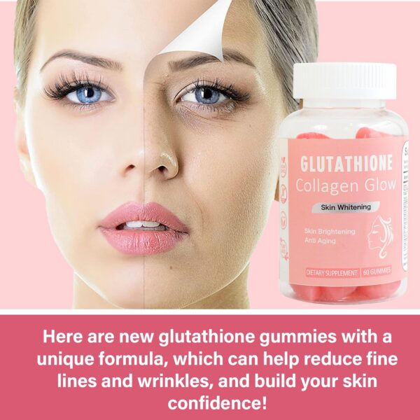 Gomitas sobre superficie