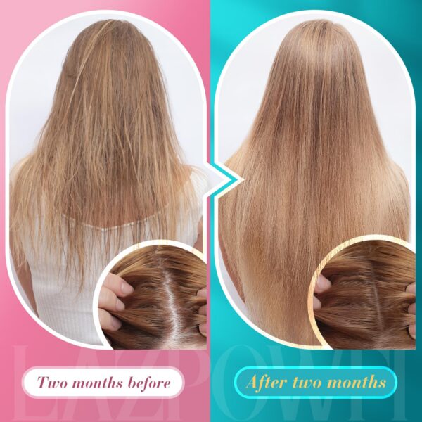 Version 1.0.0 Lazpowfi Biotin Gummies frambuesa caja