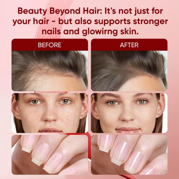 Gomitas color naranja en frasco