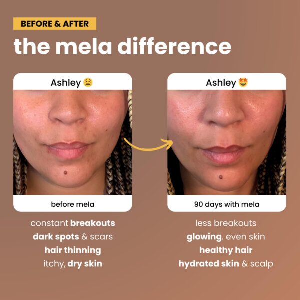 Ventana de ingredientes en etiqueta