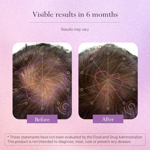 Suplemento Omvi vitaminas para cabello piel y uñas salud