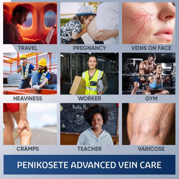 Penikosete ayuda a reducir hinchazón en piernas, tobillos y pies