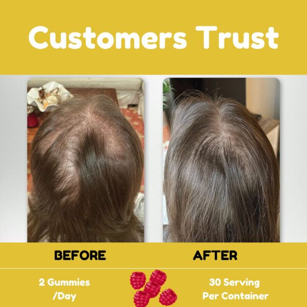 Frente de Power Grain Biotina 5000 mcg