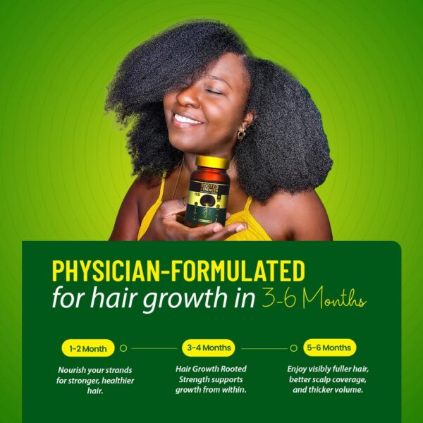 Vista lateral del frasco