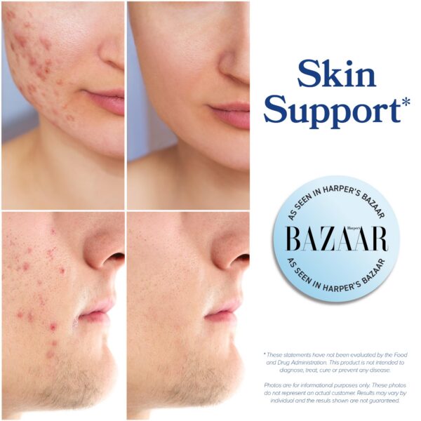 Frasco de SMNutrition CDG con etiqueta