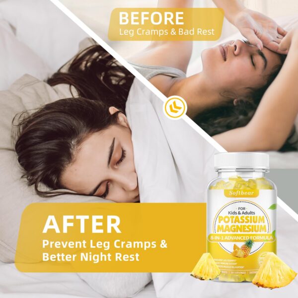 softbear gomitas piña etiqueta